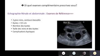 néphrologie polykystose rénale [upl. by Adniroc328]