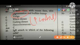 How to Differentiate Between Cushing Disease Vs Cushing SyndromeDrjehangirkhan fcps1mbbs [upl. by Martinez335]