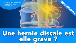 HERNIE DISCALE  Estelle grave [upl. by Inavihs]