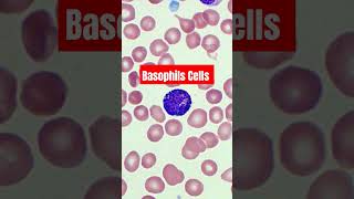 Basophils Cells  Blood smear slide microscopy Basophils bloodtest dmltlab viral trrndings [upl. by Minnnie944]