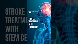 Stem Cells for Stroke Recovery stemcell stroke shorts [upl. by Mike168]