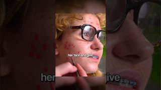 Anxious Teen Had So Much Acne So She Had A Makeover 💄 [upl. by Nosyrb]