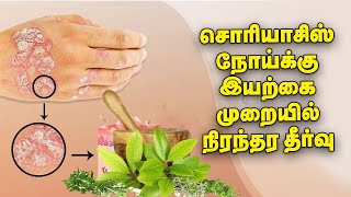 Psoriasis நோய்க்கு Steroid இல்லாத இயற்கை முறையில் நிரந்தர தீர்வு  Nalam 360  Drஅமுதா தாமோதரன் [upl. by Eward]