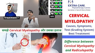 Cervical Myelopathy Physiotherapy Treatment  Causes Symptoms Test amp Grading  NO SURGERY NEEDED [upl. by Innep499]