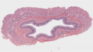 Histología del sistema digestivo II Tubo digestivo CAPÍTULO 13 [upl. by Smada312]