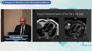 T Karamitsos  Cardiac MRI Basic knowledge for the clinical cardiologist [upl. by Iron356]