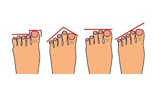 Kształt stopy zdradza wiele o Twoim charakterze [upl. by Lehman]