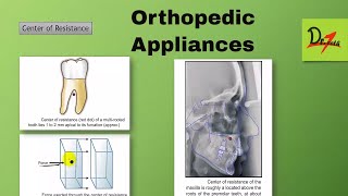 Orthopedic Appliances  Part II [upl. by Aleahc]