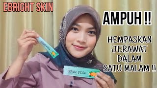 REVIEW ORANGE OCICA ACNEDERM LOTION EBRIGHT SKIN [upl. by Khosrow]