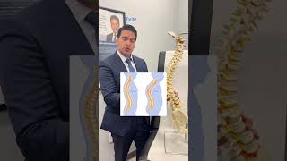 STRUGGLING WITH KYPHOSIS LEARN THE BEST TREATMENTS FOR A HUMPBACK  SPINE SURGEON  ALLIANCE ORTHO [upl. by Airb]