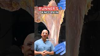 Runner’s Knee Pain Fix 🏃‍♂️ shorts [upl. by Pincus]