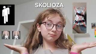 SKOLIOZA [upl. by Omocaig]