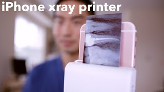 iPHONE XRAY PRINTER for DENTISTS [upl. by Cortie]