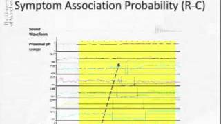 Acoustic Cough Reflux Associations in Chronic Cough [upl. by Slen]