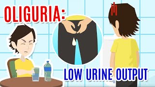 Oliguria poor urine production Causes diagnosis and care [upl. by Peppy]