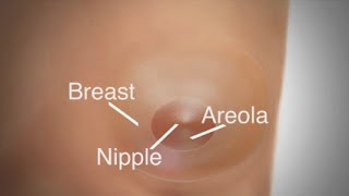 Mastectomy  Breast Reconstruction Overview [upl. by Etteinotna898]