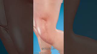 Como substituir ligamentos rompidos 😯curiosidades curiosidade fatos vocesabia [upl. by Nesilla993]