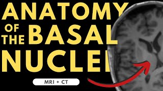 Basal ganglia basal nuclei neuroanatomy  Radiology anatomy part 1 prep  MRI  CT [upl. by Steffie]