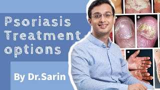 Psoriasis Treatment  Psoriasis Skin Disease  Psoriasis kya hai and best treatment  Dr Sarin [upl. by Anahc926]