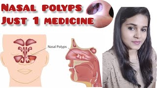 Homeopathic medicine for nasal polyps [upl. by Akiv45]