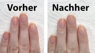 3 Tipps im Test um vergilbte Fingernägel aufzuhellen  seni Nageldesign [upl. by Aisatna]