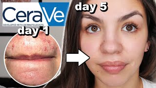 I Used CeraVe Skincare For One Week [upl. by Brunell]