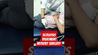 Rare scoliosis treatment without surgery by Dr Ravi scoliosistreatment chiro spine reels shorts [upl. by Kenti]