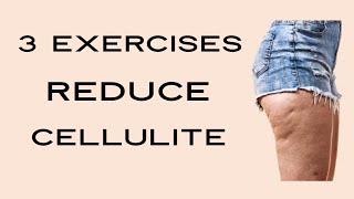 Get Rid of Cellulite Fast [upl. by Ydnik]