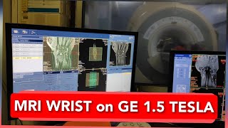 Wrist Joint MRI scan protocol positioning and planning on GE 15 Tesla  Live Demo [upl. by Julio]