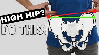 How To Self Correct FIX a High Hip Uneven Pelvis [upl. by Adiel]