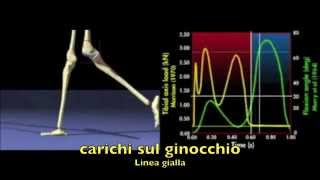 Analisi della deambulazione  carichi sul ginocchio [upl. by Meyers581]