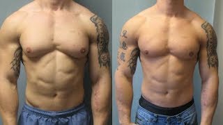 gynecomastia workout routine [upl. by Nolra784]