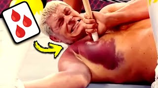 Doctor Reacts To Painful WWE Injuries [upl. by Assenna]