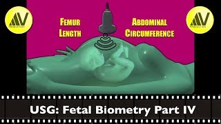 Fetal Biometry Part IV Femur Length amp Abdominal Circumference [upl. by Sila448]