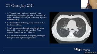 Central Valley Chronicles Challenging Coccidiomycosis Cases in PWH [upl. by Goodspeed471]