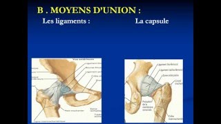 traumatologie LUXATION DE HANCHE [upl. by Licha296]