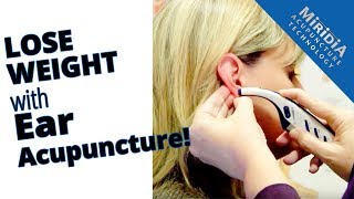 Ear Acupuncture for Weight Loss [upl. by Chuch848]