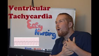 Ventricular Tachycardia  NCLEX Review [upl. by Hoj]