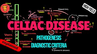 CELIAC DISEASE Pathogenesis Diagnostic markers HLADQ28 Antibodies Biopsy Treatment Explained [upl. by Bertasi510]