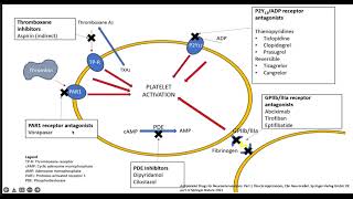 Antiplaquetarios en neurointervencionismo [upl. by Arreip]