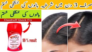 Best Anti Dandruff Shampoo  Hair Fall  Sclap  Alopecia Solution  Silky and Smooth hair [upl. by Anwahsad354]