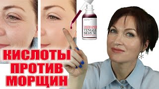 Кислоты против морщин и лучшие кислотные средства антиэйдж [upl. by Ahsiena686]