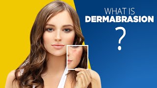 What is Dermabrasion good for  Side Effects and More [upl. by Mcclenaghan]