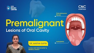 Understanding Premalignant Oral Lesions amp Leukoplakia  Signs amp Prevention  Health Tips [upl. by Zehe]