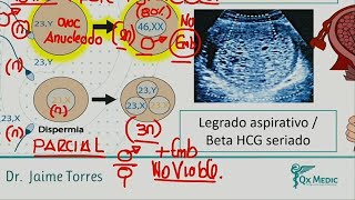 ENFERMEDAD TROFOBLÁSTICA GESTACIONAL QX MEDIC [upl. by Carmine576]