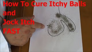 Itchy Balls Cure Watch This OTC Miracle Jock Itch Treatment [upl. by Nuajed]