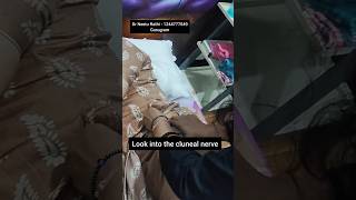 Needle the cluneal nerve to relieve the lower back pain 💥 lowerbackpain trending ytshorts [upl. by Nnaylime]