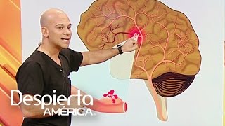 ¿Cómo detectar las señales de un aneurisma cerebral [upl. by Brinn272]