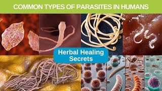 Common Parasites In Humans And Where They Come From [upl. by Bish]