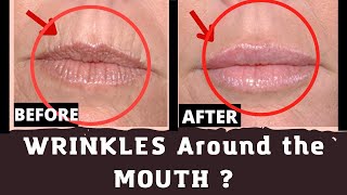 How to Get Rid of Wrinkles around the Mouth  upper lip wrinkles [upl. by Enilorak]